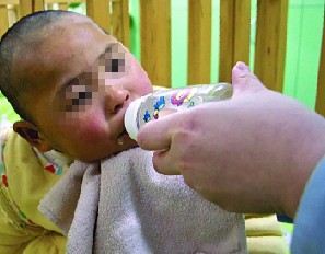 小儿脑瘫康复病例：小旺